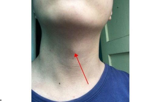 女生有喉结图片,独特生理现象的视觉解读