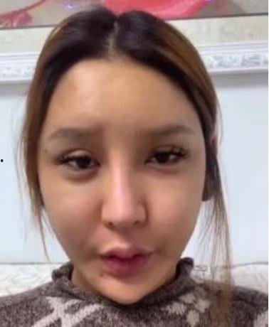 整容失败的网红有哪些,美丽背后的代价与反思